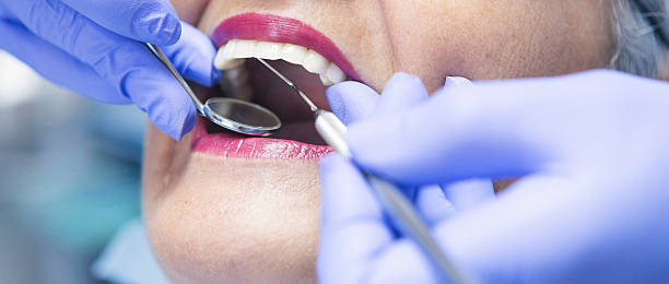 Best Emergency Wisdom Tooth Extraction in Silver Lake, NJ